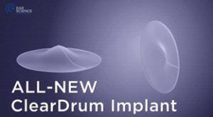 ترميم پرده گوش با ايمپلنت ابريشمي